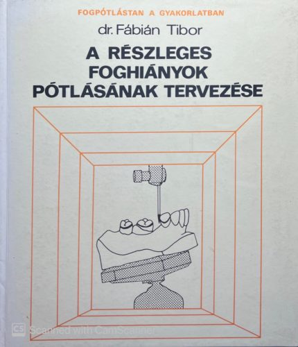 A részleges foghiányok pótlásának tervezése -  Dr. Fábián Tibor